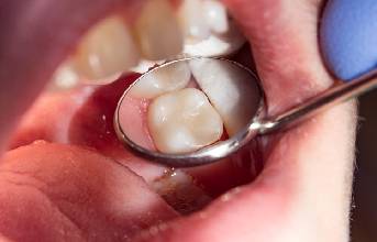 Orthodontic Treatment