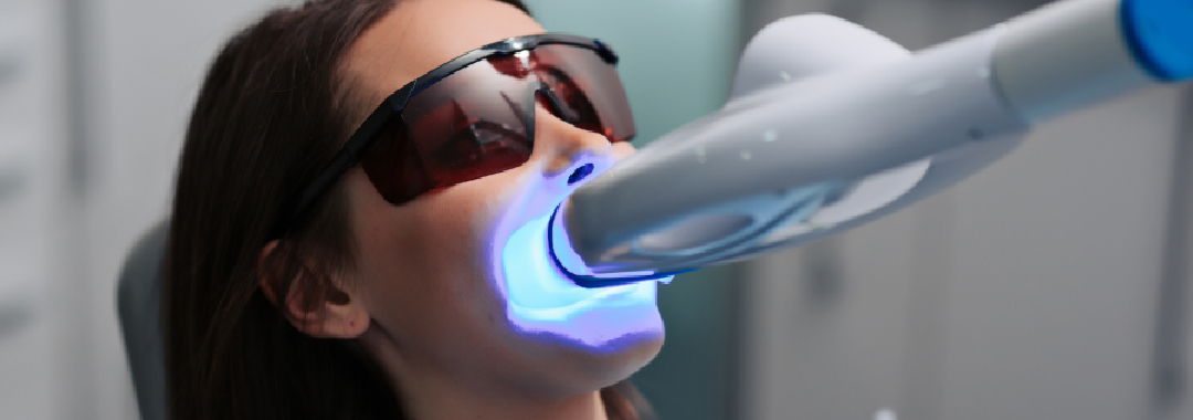 Teeth Whitening 